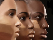 Décapage de la peau : phénomène de mode ou symbole d’un mal être profond ?